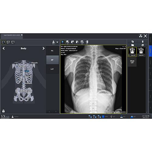 HF 525 PLUS DR CHEST EXAM Exposure Min NoGenerator